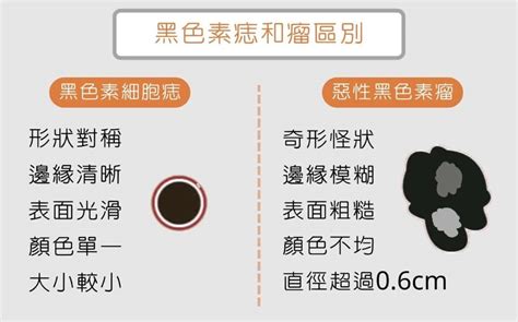 為什麼身上會有痣|為什麼臉上的痣越來越多？皮膚科醫師解析長痣原因、。